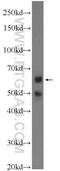 Protein Phosphatase 2 Regulatory Subunit Balpha antibody, 16569-1-AP, Proteintech Group, Western Blot image 