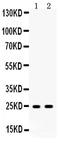 Apolipoprotein A1 antibody, PB9845, Boster Biological Technology, Western Blot image 