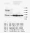 S100 Calcium Binding Protein B antibody, LS-C172094, Lifespan Biosciences, Western Blot image 