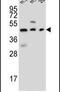 STEAP2 Metalloreductase antibody, PA5-25495, Invitrogen Antibodies, Western Blot image 