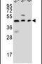 STEAP2 Metalloreductase antibody, PA5-25495, Invitrogen Antibodies, Western Blot image 