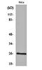 BCAS2 Pre-MRNA Processing Factor antibody, orb160103, Biorbyt, Western Blot image 