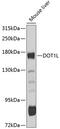 DOT1 Like Histone Lysine Methyltransferase antibody, 13-973, ProSci, Western Blot image 