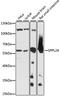 Signal peptide peptidase-like 2A antibody, LS-C750508, Lifespan Biosciences, Western Blot image 