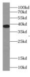 Transmembrane Protein 241 antibody, FNab01044, FineTest, Western Blot image 