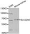 Solute Carrier Family 22 Member 6 antibody, LS-C332406, Lifespan Biosciences, Western Blot image 