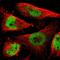 RING finger protein 38 antibody, PA5-53391, Invitrogen Antibodies, Immunofluorescence image 