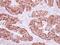 A-Kinase Anchoring Protein 1 antibody, PA5-30266, Invitrogen Antibodies, Immunohistochemistry frozen image 