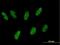Zinc Finger Protein 343 antibody, H00079175-B01P, Novus Biologicals, Immunocytochemistry image 