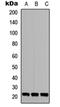 TGFB Induced Factor Homeobox 2 Like Y-Linked antibody, orb234970, Biorbyt, Western Blot image 