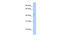 Gamma-Aminobutyric Acid Type A Receptor Alpha5 Subunit antibody, 25-238, ProSci, Western Blot image 