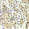 Zinc Finger Protein 264 antibody, A7356, ABclonal Technology, Immunohistochemistry paraffin image 