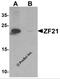 Zinc Finger FYVE-Type Containing 21 antibody, 6935, ProSci, Western Blot image 
