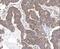 Survivin antibody, PA5-27087, Invitrogen Antibodies, Immunohistochemistry paraffin image 