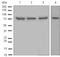 Glutamine--Fructose-6-Phosphate Transaminase 1 antibody, ab125069, Abcam, Western Blot image 