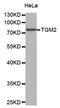 Transglutaminase 2 antibody, STJ25835, St John