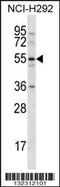 C-Type Lectin Domain Family 18 Member A antibody, 56-600, ProSci, Western Blot image 