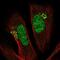 Proteasome 26S Subunit, Non-ATPase 11 antibody, NBP2-55793, Novus Biologicals, Immunocytochemistry image 