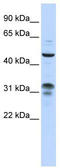 Zinc Finger Protein 765 antibody, TA339664, Origene, Western Blot image 