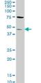 Serine/Threonine Kinase 32C antibody, H00282974-M02, Novus Biologicals, Western Blot image 