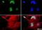 Ubiquitin Conjugating Enzyme E2 E1 antibody, NBP1-78983, Novus Biologicals, Immunofluorescence image 