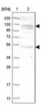 Ankyrin Repeat And FYVE Domain Containing 1 antibody, PA5-55096, Invitrogen Antibodies, Western Blot image 