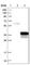 Dehydrogenase/Reductase 7B antibody, HPA012132, Atlas Antibodies, Western Blot image 