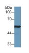 Aldehyde Dehydrogenase 7 Family Member A1 antibody, LS-C292710, Lifespan Biosciences, Western Blot image 