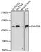 DNA Methyltransferase 3 Beta antibody, 18-859, ProSci, Western Blot image 