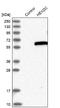 Hexosaminidase D antibody, NBP1-83574, Novus Biologicals, Western Blot image 
