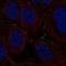 Testis Specific Serine Kinase 4 antibody, HPA060660, Atlas Antibodies, Immunofluorescence image 