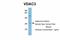 Voltage Dependent Anion Channel 3 antibody, ARP35180_P050, Aviva Systems Biology, Western Blot image 