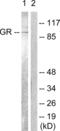 Nuclear Receptor Subfamily 3 Group C Member 1 antibody, abx012772, Abbexa, Western Blot image 