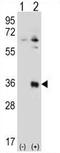 Testis Specific Serine Kinase 6 antibody, AP54391PU-N, Origene, Western Blot image 