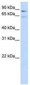 Coagulation Factor XIII B Chain antibody, TA346313, Origene, Western Blot image 