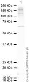 Insulin Receptor Substrate 2 antibody, ab3690, Abcam, Western Blot image 