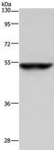 Cytochrome P450 Family 3 Subfamily A Member 4 antibody, TA324141, Origene, Western Blot image 
