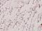 Thyroid Hormone Receptor Beta antibody, A01181-1, Boster Biological Technology, Immunohistochemistry frozen image 