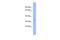 Zinc Finger Protein 80 antibody, A15540, Boster Biological Technology, Western Blot image 