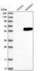 SAM Domain, SH3 Domain And Nuclear Localization Signals 1 antibody, NBP1-82598, Novus Biologicals, Western Blot image 