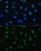 General Transcription Factor IIE Subunit 1 antibody, GTX66351, GeneTex, Immunofluorescence image 