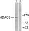 Histone Deacetylase 6 antibody, PA5-38103, Invitrogen Antibodies, Western Blot image 
