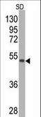 Superoxide Dismutase 2 antibody, LS-B9357, Lifespan Biosciences, Western Blot image 