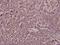 ADP Ribosylation Factor 4 antibody, A05121, Boster Biological Technology, Immunohistochemistry frozen image 