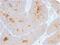 Extracellular matrix protein 1 antibody, GTX02627, GeneTex, Immunohistochemistry paraffin image 