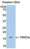 Fibroblast Growth Factor Receptor 1 antibody, LS-C303284, Lifespan Biosciences, Western Blot image 