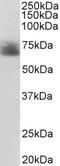 Solute Carrier Family 6 Member 4 antibody, EB06743, Everest Biotech, Western Blot image 