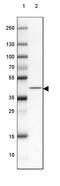 Reticulocalbin 2 antibody, PA5-56543, Invitrogen Antibodies, Western Blot image 