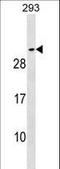 Synaptosome Associated Protein 25 antibody, LS-B10970, Lifespan Biosciences, Western Blot image 