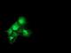 Catalase antibody, NBP2-00492, Novus Biologicals, Immunofluorescence image 